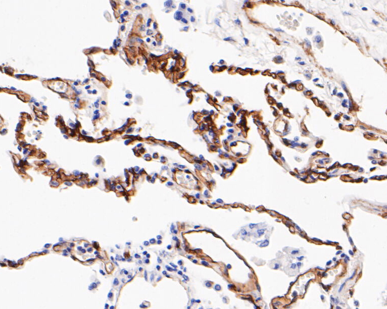 Immunohistochemical analysis of paraffin-embedded human lung tissue using anti-Caveolin-1 antibody. The section was pre-treated using heat mediated antigen retrieval with Tris-EDTA buffer (pH 8.0-8.4) for 20 minutes.The tissues were blocked in 5% BSA for 30 minutes at room temperature, washed with ddH2O and PBS, and then probed with the primary antibody (EM1902-01, 1/1000) for 30 minutes at room temperature. The detection was performed using an HRP conjugated compact polymer system. DAB was used as the chromogen. Tissues were counterstained with hematoxylin and mounted with DPX.