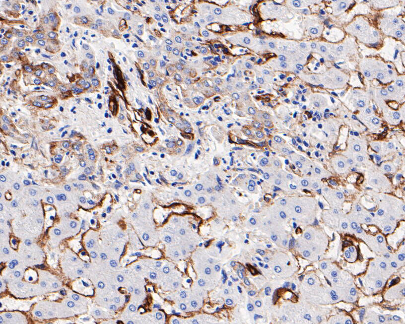 Immunohistochemical analysis of paraffin-embedded human liver tissue using anti-Caveolin-1 antibody. The section was pre-treated using heat mediated antigen retrieval with Tris-EDTA buffer (pH 8.0-8.4) for 20 minutes.The tissues were blocked in 5% BSA for 30 minutes at room temperature, washed with ddH2O and PBS, and then probed with the primary antibody (EM1902-01, 1/1000) for 30 minutes at room temperature. The detection was performed using an HRP conjugated compact polymer system. DAB was used as the chromogen. Tissues were counterstained with hematoxylin and mounted with DPX.