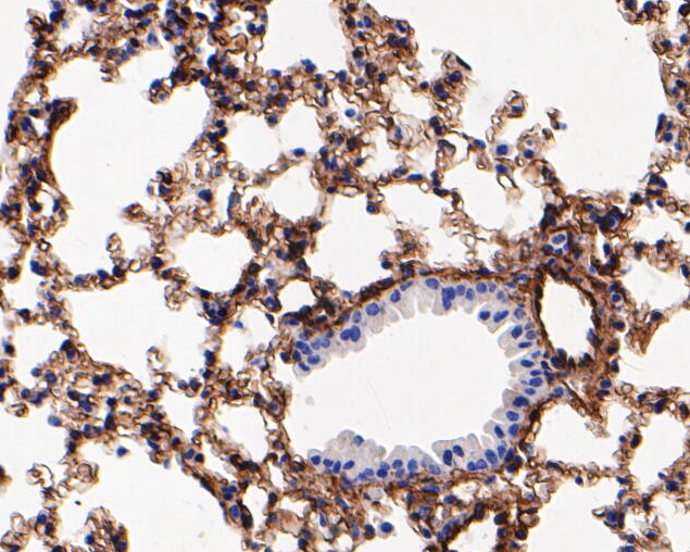 Immunohistochemical analysis of paraffin-embedded mouse lung tissue using anti-Caveolin-1 antibody. The section was pre-treated using heat mediated antigen retrieval with Tris-EDTA buffer (pH 8.0-8.4) for 20 minutes.The tissues were blocked in 5% BSA for 30 minutes at room temperature, washed with ddH2O and PBS, and then probed with the primary antibody (EM1902-01, 1/1000) for 30 minutes at room temperature. The detection was performed using an HRP conjugated compact polymer system. DAB was used as the chromogen. Tissues were counterstained with hematoxylin and mounted with DPX.
