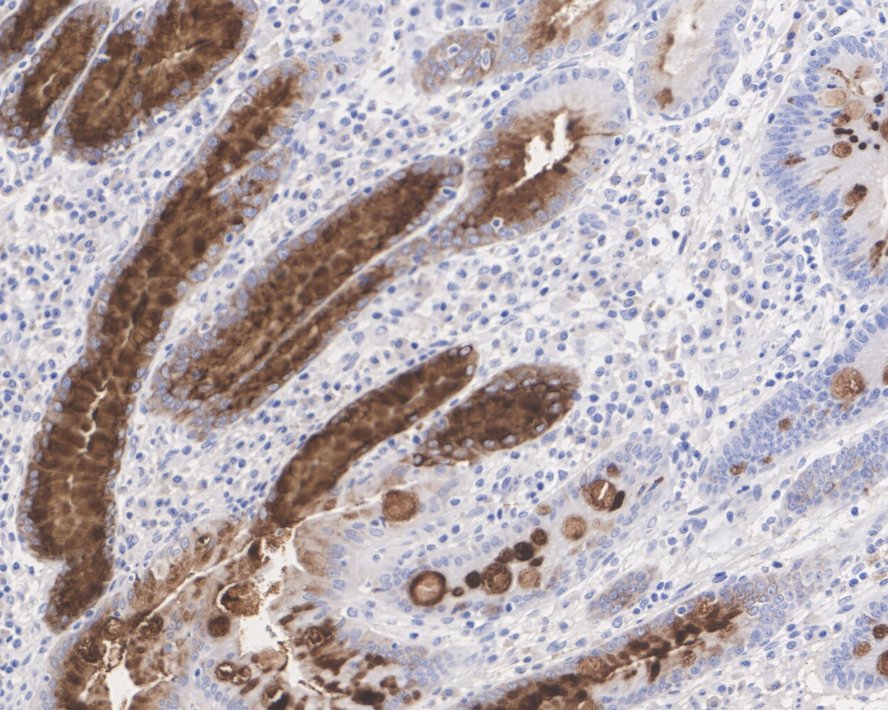 Immunohistochemical analysis of paraffin-embedded human stomach tissue using anti-MUC5AC antibody. The section was pre-treated using heat mediated antigen retrieval with Tris-EDTA buffer (pH 8.0-8.4) for 20 minutes.The tissues were blocked in 5% BSA for 30 minutes at room temperature, washed with ddH2O and PBS, and then probed with the primary antibody (EM1902-02, 1/200) for 30 minutes at room temperature. The detection was performed using an HRP conjugated compact polymer system. DAB was used as the chromogen. Tissues were counterstained with hematoxylin and mounted with DPX.