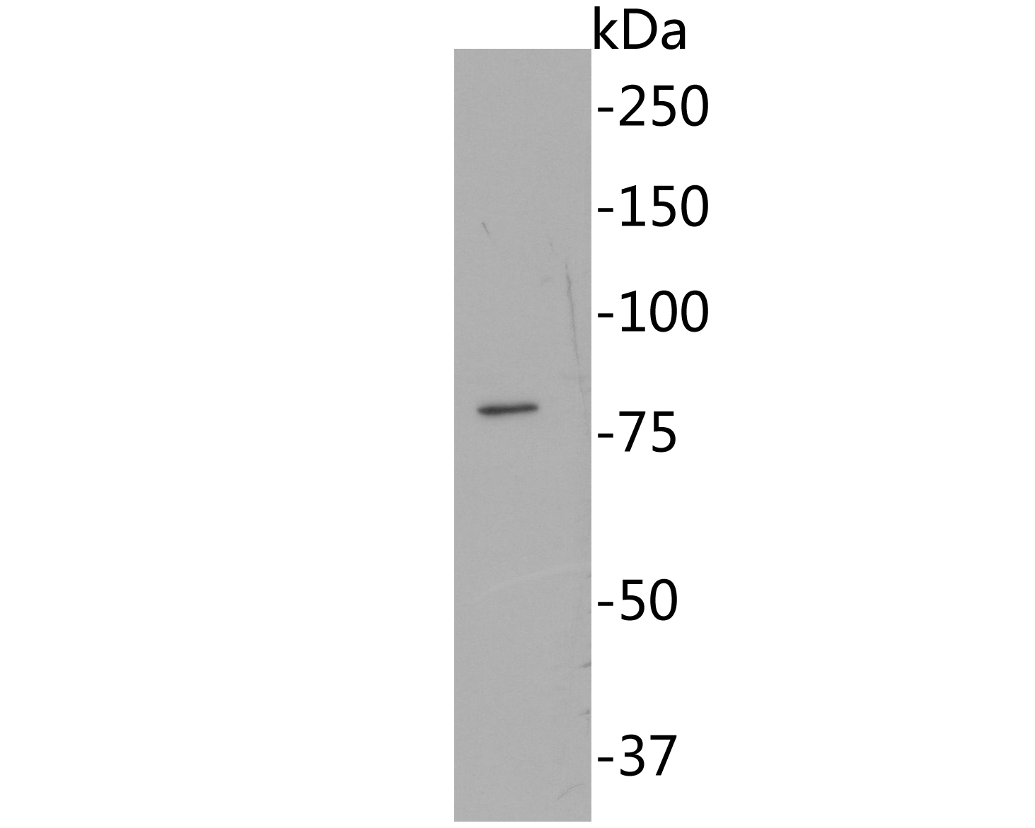 Western blot analysis of RAP80 on Siha cell lysates. Proteins were transferred to a PVDF membrane and blocked with 5% BSA in PBS for 1 hour at room temperature. The primary antibody (EM1902-05, 1/500) was used in 5% BSA at room temperature for 2 hours. Goat Anti-Mouse IgG - HRP Secondary Antibody (HA1006) at 1:5,000 dilution was used for 1 hour at room temperature.
