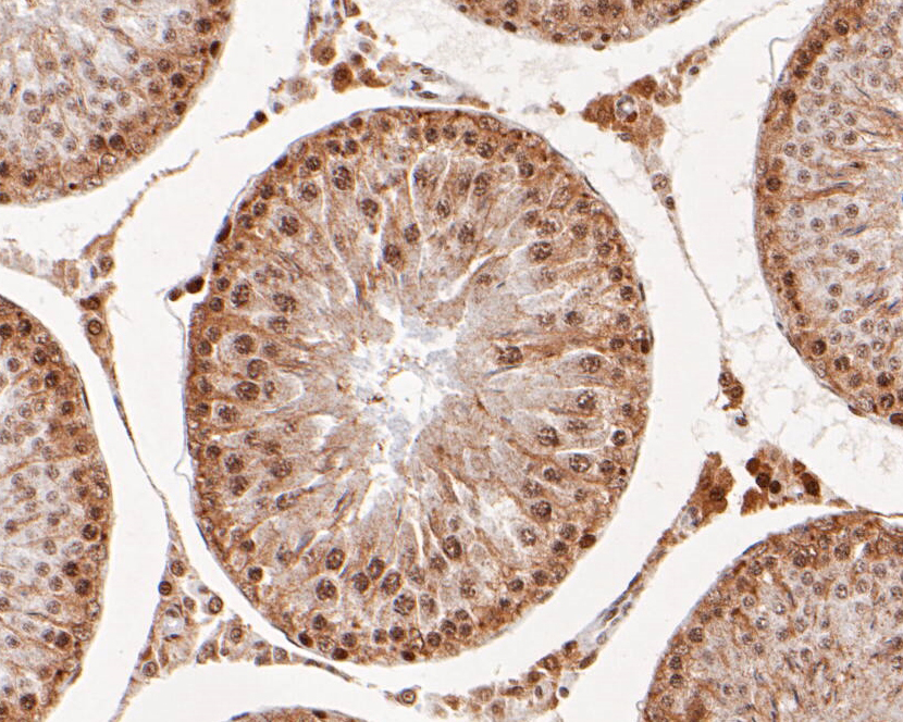 Immunohistochemical analysis of paraffin-embedded rat testis tissue using anti-RAP80 antibody. The section was pre-treated using heat mediated antigen retrieval with Tris-EDTA buffer (pH 8.0-8.4) for 20 minutes.The tissues were blocked in 5% BSA for 30 minutes at room temperature, washed with ddH2O and PBS, and then probed with the primary antibody (EM1902-05, 1/200) for 30 minutes at room temperature. The detection was performed using an HRP conjugated compact polymer system. DAB was used as the chromogen. Tissues were counterstained with hematoxylin and mounted with DPX.