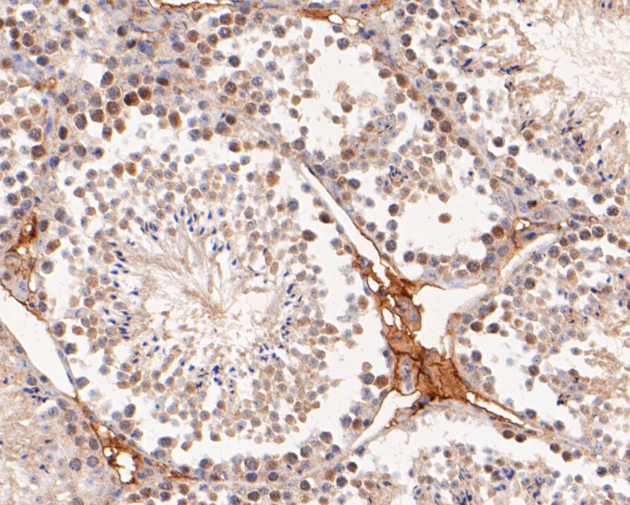 Immunohistochemical analysis of paraffin-embedded mouse testis tissue using anti-RAP80 antibody. The section was pre-treated using heat mediated antigen retrieval with Tris-EDTA buffer (pH 8.0-8.4) for 20 minutes.The tissues were blocked in 5% BSA for 30 minutes at room temperature, washed with ddH2O and PBS, and then probed with the primary antibody (EM1902-05, 1/50) for 30 minutes at room temperature. The detection was performed using an HRP conjugated compact polymer system. DAB was used as the chromogen. Tissues were counterstained with hematoxylin and mounted with DPX.