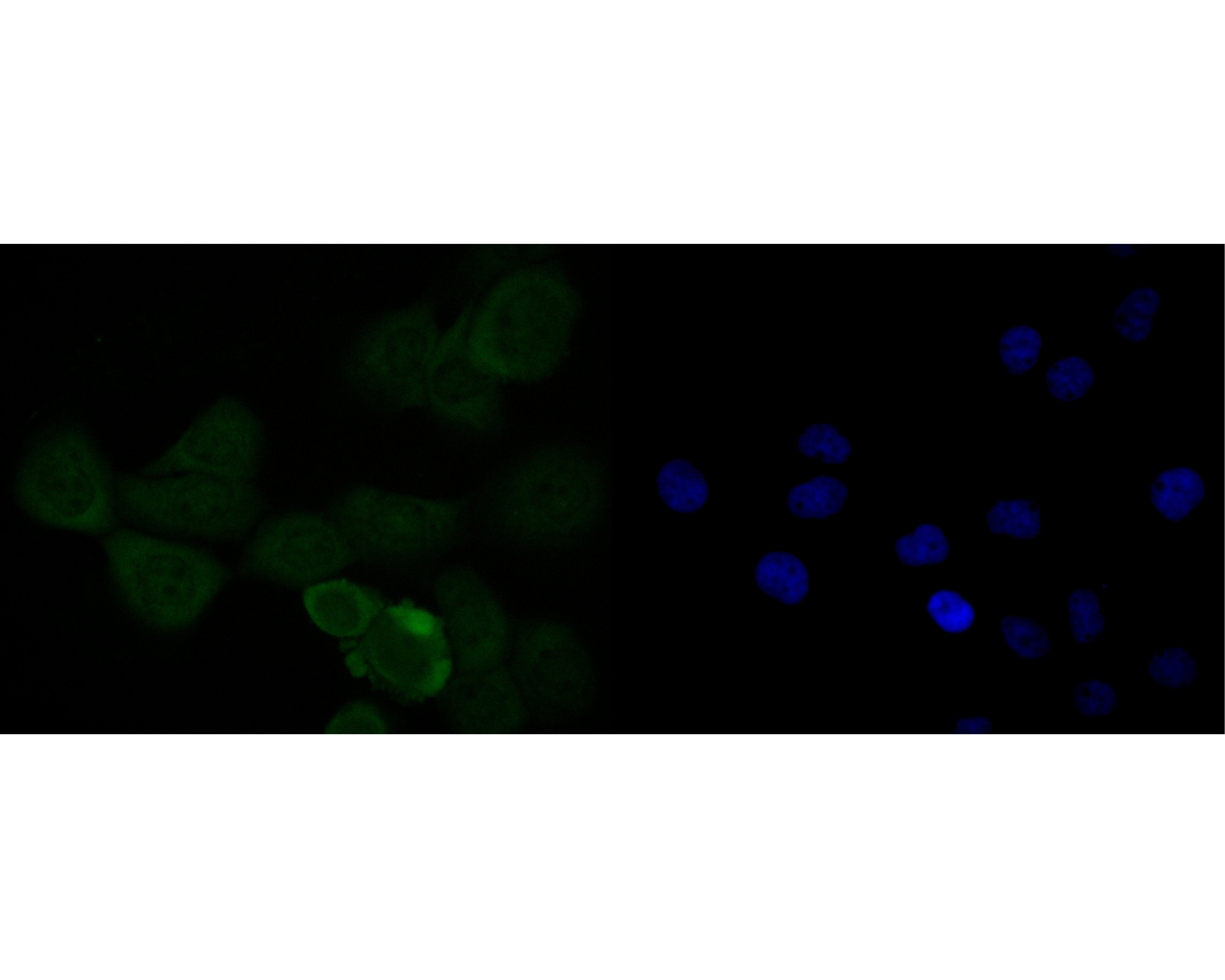 ICC staining of HMGB2 in A431 cells (green). Formalin fixed cells were permeabilized with 0.1% Triton X-100 in TBS for 10 minutes at room temperature and blocked with 1% Blocker BSA for 15 minutes at room temperature. Cells were probed with the primary antibody (EM1902-06, 1/50) for 1 hour at room temperature, washed with PBS. Alexa Fluor®488 Goat anti-Mouse IgG was used as the secondary antibody at 1/1,000 dilution. The nuclear counter stain is DAPI (blue).