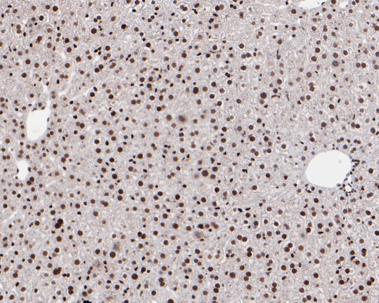 Immunohistochemical analysis of paraffin-embedded mouse liver tissue using anti-HMGB2 antibody. The section was pre-treated using heat mediated antigen retrieval with sodium citrate buffer (pH 6.0) for 20 minutes. The tissues were blocked in 5% BSA for 30 minutes at room temperature, washed with ddH2O and PBS, and then probed with the primary antibody (EM1902-06, 1/1,000)  for 30 minutes at room temperature. The detection was performed using an HRP conjugated compact polymer system. DAB was used as the chromogen. Tissues were counterstained with hematoxylin and mounted with DPX.