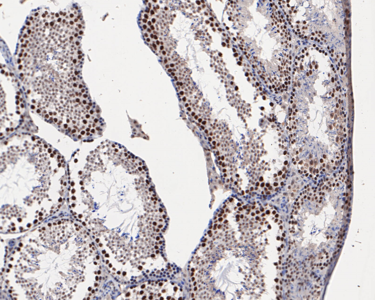 Immunohistochemical analysis of paraffin-embedded mouse testis tissue using anti-HMGB2 antibody. The section was pre-treated using heat mediated antigen retrieval with sodium citrate buffer (pH 6.0) for 20 minutes. The tissues were blocked in 5% BSA for 30 minutes at room temperature, washed with ddH2O and PBS, and then probed with the primary antibody (EM1902-06, 1/1,000)  for 30 minutes at room temperature. The detection was performed using an HRP conjugated compact polymer system. DAB was used as the chromogen. Tissues were counterstained with hematoxylin and mounted with DPX.
