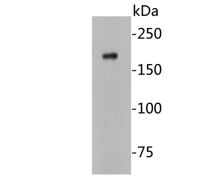 Western blot analysis of Caspr on Hela cell lysates. Proteins were transferred to a PVDF membrane and blocked with 5% BSA in PBS for 1 hour at room temperature. The primary antibody (EM1902-07, 1/500) was used in 5% BSA at room temperature for 2 hours. Goat Anti-Mouse IgG - HRP Secondary Antibody (HA1006) at 1:5,000 dilution was used for 1 hour at room temperature.