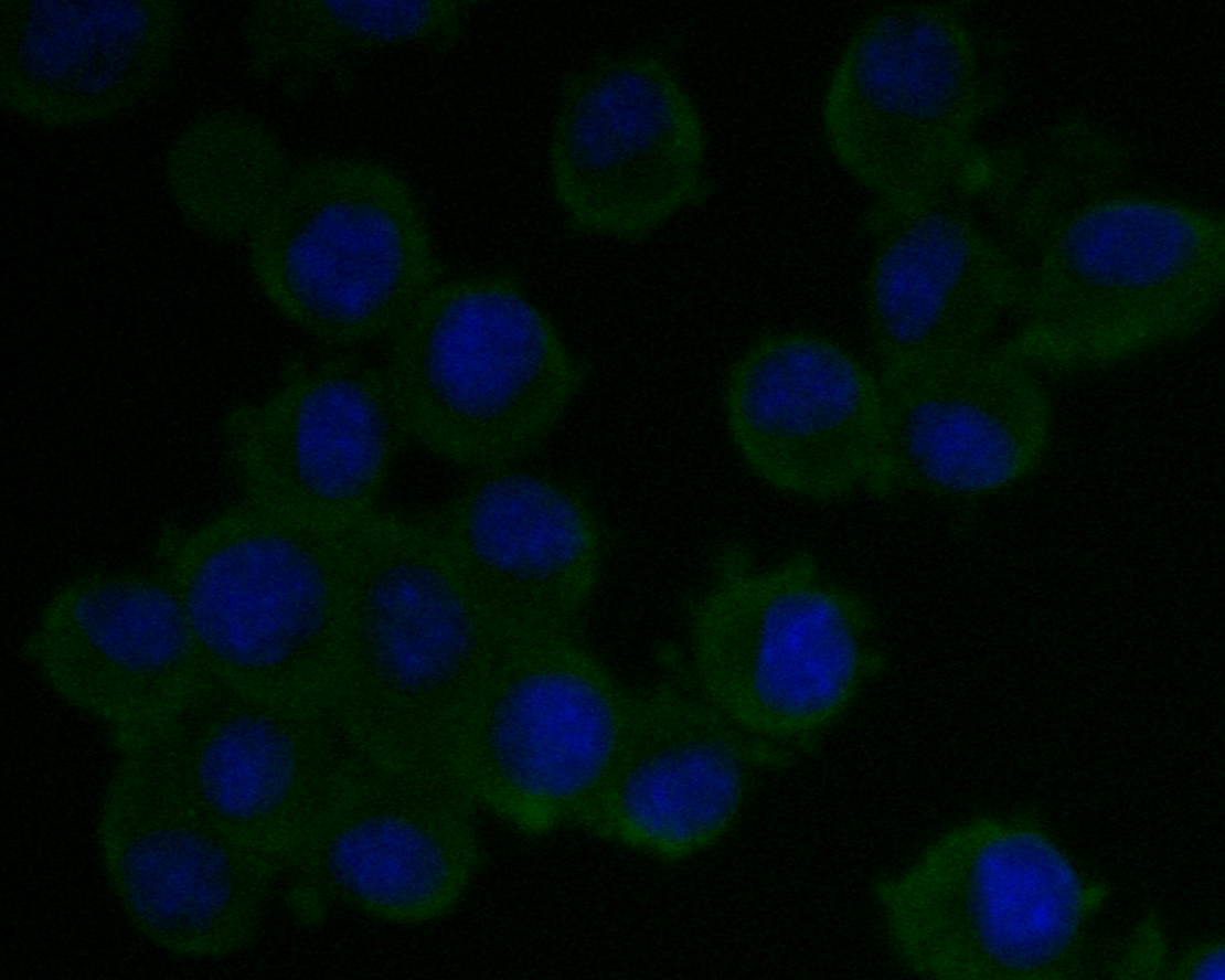 ICC staining of Caspr in N2A cells (green). Formalin fixed cells were permeabilized with 0.1% Triton X-100 in TBS for 10 minutes at room temperature and blocked with 1% Blocker BSA for 15 minutes at room temperature. Cells were probed with the primary antibody (EM1902-07, 1/50) for 1 hour at room temperature, washed with PBS. Alexa Fluor®488 Goat anti-Mouse IgG was used as the secondary antibody at 1/1,000 dilution. The nuclear counter stain is DAPI (blue).