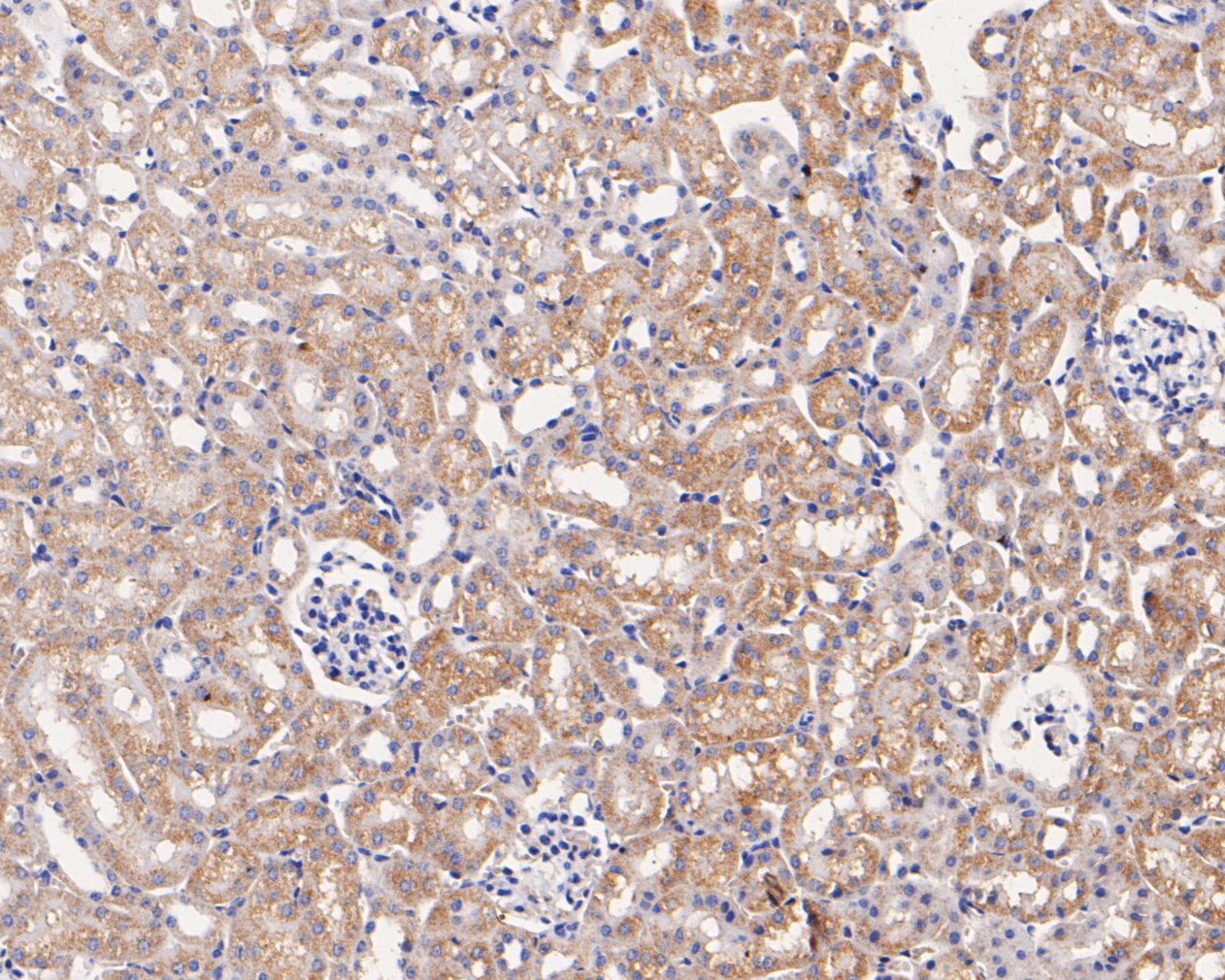 Immunohistochemical analysis of paraffin-embedded mouse kidney tissue using anti-Caspr antibody. The section was pre-treated using heat mediated antigen retrieval with Tris-EDTA buffer (pH 8.0-8.4) for 20 minutes.The tissues were blocked in 5% BSA for 30 minutes at room temperature, washed with ddH2O and PBS, and then probed with the primary antibody (EM1902-07, 1/50) for 30 minutes at room temperature. The detection was performed using an HRP conjugated compact polymer system. DAB was used as the chromogen. Tissues were counterstained with hematoxylin and mounted with DPX.