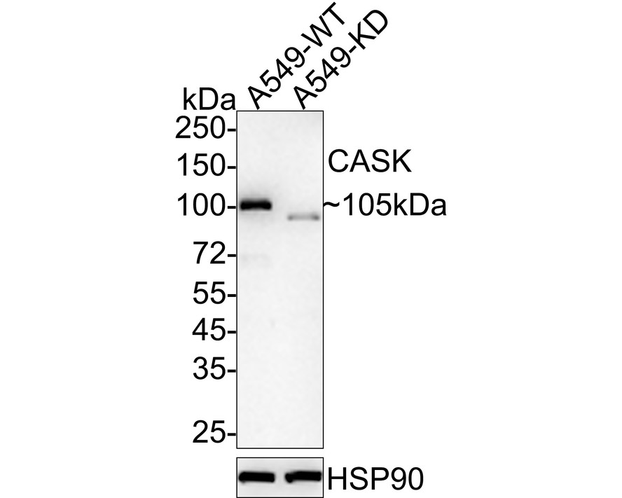 Western blot analysis of CASK on different lysates. Proteins were transferred to a PVDF membrane and blocked with 5% BSA in PBS for 1 hour at room temperature. The primary antibody (EM1902-08, 1/500) was used in 5% BSA at room temperature for 2 hours. Goat Anti-Mouse IgG - HRP Secondary Antibody (HA1006) at 1:5,000 dilution was used for 1 hour at room temperature.<br />
Positive control: <br />
Lane 1: Siha cell lysate<br />
Lane 2: A549 cell lysate