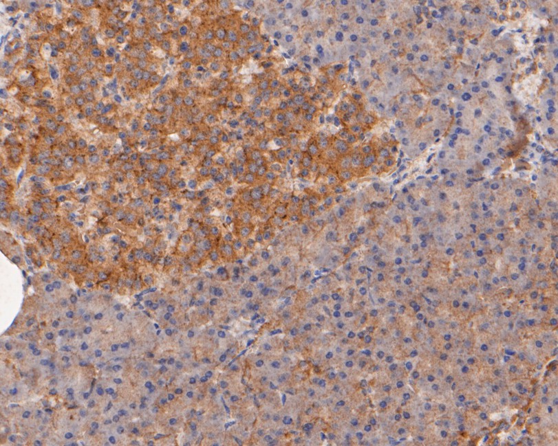 Immunohistochemical analysis of paraffin-embedded mouse brain tissue using anti-CASK antibody. The section was pre-treated using heat mediated antigen retrieval with Tris-EDTA buffer (pH 8.0-8.4) for 20 minutes.The tissues were blocked in 5% BSA for 30 minutes at room temperature, washed with ddH2O and PBS, and then probed with the primary antibody (EM1902-08, 1/50) for 30 minutes at room temperature. The detection was performed using an HRP conjugated compact polymer system. DAB was used as the chromogen. Tissues were counterstained with hematoxylin and mounted with DPX.