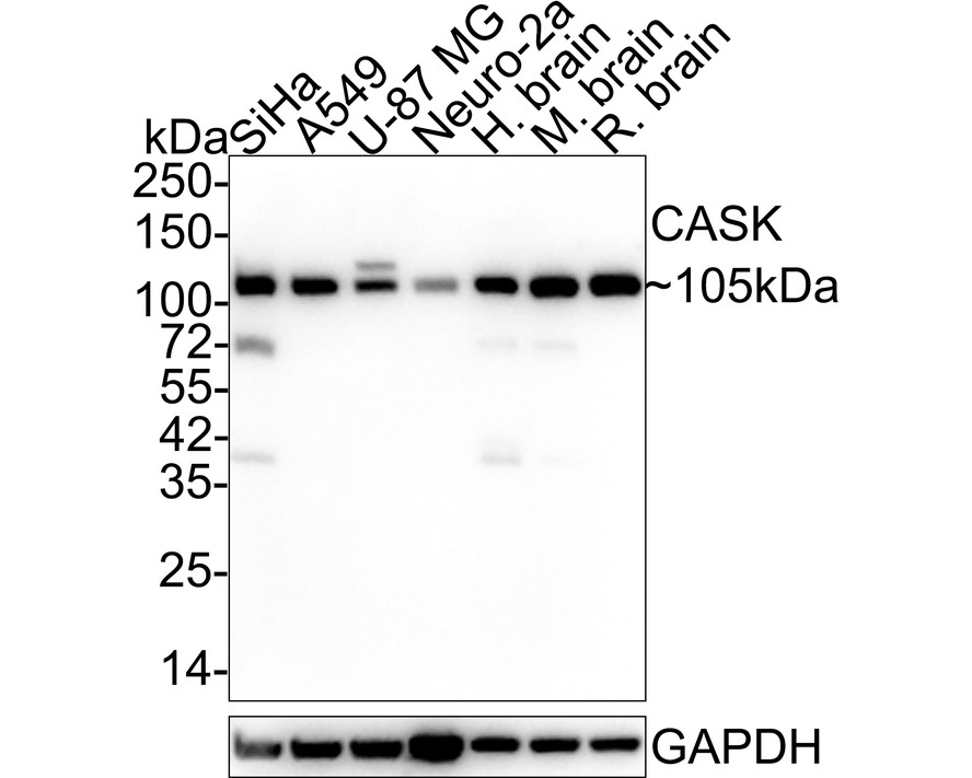 Western blot analysis of CASK on different lysates. Proteins were transferred to a PVDF membrane and blocked with 5% BSA in PBS for 1 hour at room temperature. The primary antibody (EM1902-09, 1/500) was used in 5% BSA at room temperature for 2 hours. Goat Anti-Mouse IgG - HRP Secondary Antibody (HA1006) at 1:5,000 dilution was used for 1 hour at room temperature.<br />
Positive control: <br />
Lane 1: Siha cell lysate<br />
Lane 2: A549 cell lysate