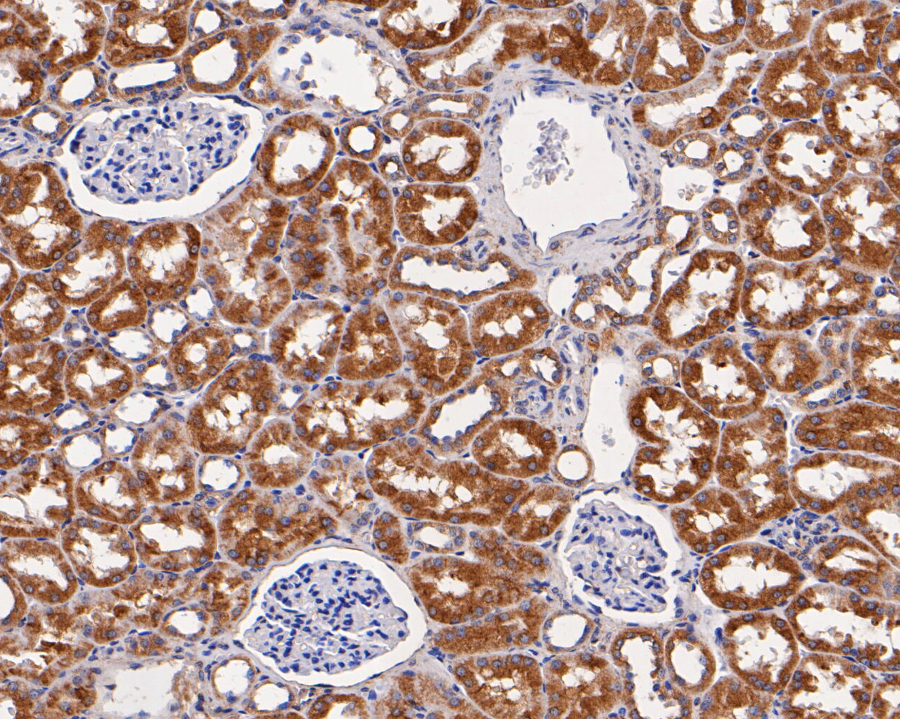 Immunohistochemical analysis of paraffin-embedded human kidney tissue using anti-Caspr antibody. The section was pre-treated using heat mediated antigen retrieval with Tris-EDTA buffer (pH 8.0-8.4) for 20 minutes.The tissues were blocked in 5% BSA for 30 minutes at room temperature, washed with ddH2O and PBS, and then probed with the primary antibody (EM1902-10, 1/200) for 30 minutes at room temperature. The detection was performed using an HRP conjugated compact polymer system. DAB was used as the chromogen. Tissues were counterstained with hematoxylin and mounted with DPX.