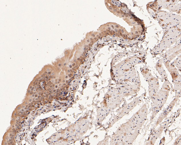 Immunohistochemical analysis of paraffin-embedded rat bladder tissue using anti-COX2 antibody. The section was pre-treated using heat mediated antigen retrieval with sodium citrate buffer (pH 6.0) for 20 minutes. The tissues were blocked in 5% BSA for 30 minutes at room temperature, washed with ddH2O and PBS, and then probed with the primary antibody (EM1902-11, 1/100)  for 30 minutes at room temperature. The detection was performed using an HRP conjugated compact polymer system. DAB was used as the chromogen. Tissues were counterstained with hematoxylin and mounted with DPX.