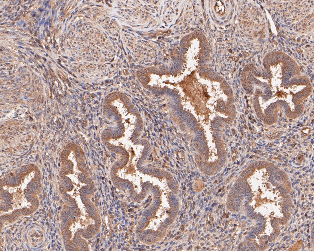 Immunohistochemical analysis of paraffin-embedded human womb tissue using anti-COX2 antibody. The section was pre-treated using heat mediated antigen retrieval with sodium citrate buffer (pH 6.0) for 20 minutes. The tissues were blocked in 5% BSA for 30 minutes at room temperature, washed with ddH2O and PBS, and then probed with the primary antibody (EM1902-11, 1/100)  for 30 minutes at room temperature. The detection was performed using an HRP conjugated compact polymer system. DAB was used as the chromogen. Tissues were counterstained with hematoxylin and mounted with DPX.