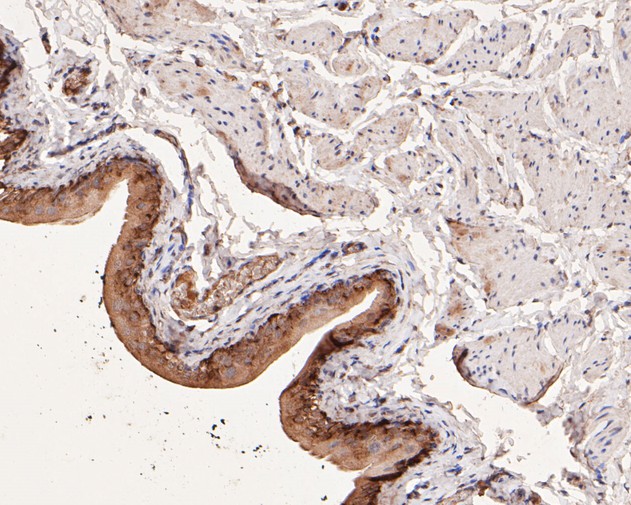 Immunohistochemical analysis of paraffin-embedded rat bladder tissue using anti-COX2 antibody. The section was pre-treated using heat mediated antigen retrieval with sodium citrate buffer (pH 6.0) for 20 minutes. The tissues were blocked in 5% BSA for 30 minutes at room temperature, washed with ddH2O and PBS, and then probed with the primary antibody (EM1902-12, 1/100)  for 30 minutes at room temperature. The detection was performed using an HRP conjugated compact polymer system. DAB was used as the chromogen. Tissues were counterstained with hematoxylin and mounted with DPX.
