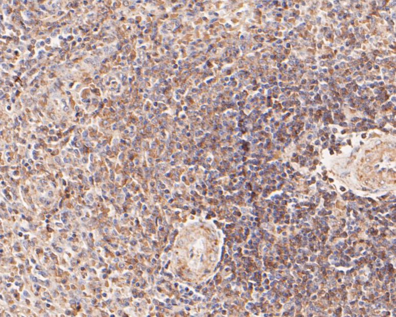Immunohistochemical analysis of paraffin-embedded human spleen tissue using anti-CD22 antibody. The section was pre-treated using heat mediated antigen retrieval with Tris-EDTA buffer (pH 8.0-8.4) for 20 minutes.The tissues were blocked in 5% BSA for 30 minutes at room temperature, washed with ddH2O and PBS, and then probed with the primary antibody (EM1902-13, 1/1000) for 30 minutes at room temperature. The detection was performed using an HRP conjugated compact polymer system. DAB was used as the chromogen. Tissues were counterstained with hematoxylin and mounted with DPX.