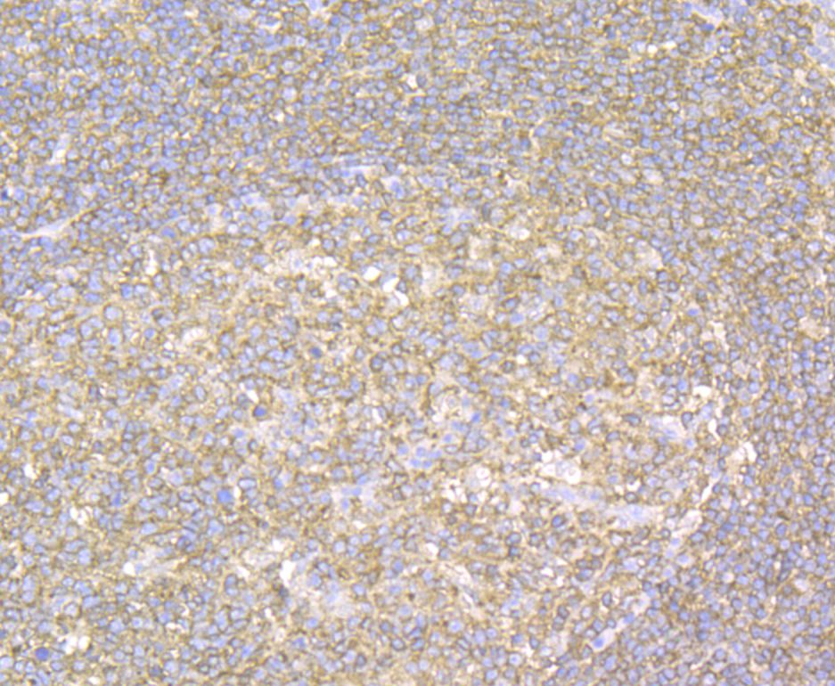 Immunohistochemical analysis of paraffin-embedded human tonsil tissue using anti-YKL-40 / CHI3L1 antibody. The section was pre-treated using heat mediated antigen retrieval with Tris-EDTA buffer (pH 8.0-8.4) for 20 minutes.The tissues were blocked in 5% BSA for 30 minutes at room temperature, washed with ddH2O and PBS, and then probed with the antibody (EM1902-14) at 1/50 dilution, for 30 minutes at room temperature and detected using an HRP conjugated compact polymer system. DAB was used as the chrogen. Counter stained with hematoxylin and mounted with DPX.