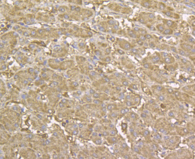 Immunohistochemical analysis of paraffin-embedded human liver tissue using anti-YKL-40 / CHI3L1 antibody. The section was pre-treated using heat mediated antigen retrieval with sodium citrate buffer (pH 6.0) for 20 minutes. The tissues were blocked in 5% BSA for 30 minutes at room temperature, washed with ddH2O and PBS, and then probed with the antibody (EM1902-14) at 1/200 dilution, for 30 minutes at room temperature and detected using an HRP conjugated compact polymer system. DAB was used as the chrogen. Counter stained with hematoxylin and mounted with DPX.