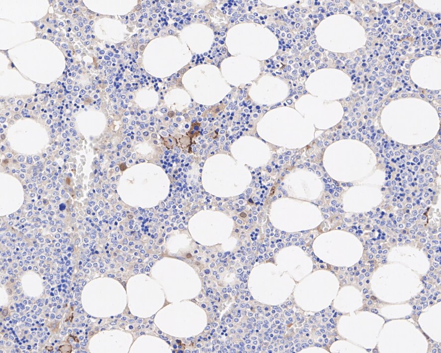 Immunohistochemical analysis of paraffin-embedded human spleen tissue using anti-CD42b antibody. The section was pre-treated using heat mediated antigen retrieval with Tris-EDTA buffer (pH 8.0-8.4) for 20 minutes.The tissues were blocked in 5% BSA for 30 minutes at room temperature, washed with ddH2O and PBS, and then probed with the primary antibody (EM1902-15, 1/100) for 30 minutes at room temperature. The detection was performed using an HRP conjugated compact polymer system. DAB was used as the chromogen. Tissues were counterstained with hematoxylin and mounted with DPX.