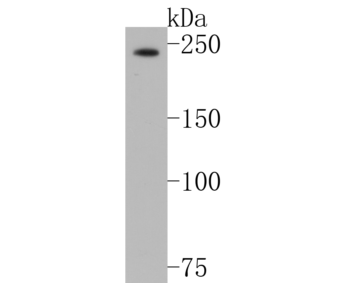 Western blot analysis of NuMA on Raji cell lysates. Proteins were transferred to a PVDF membrane and blocked with 5% BSA in PBS for 1 hour at room temperature. The primary antibody (EM1902-16, 1/500) was used in 5% BSA at room temperature for 2 hours. Goat Anti-Mouse IgG - HRP Secondary Antibody (HA1006) at 1:5,000 dilution was used for 1 hour at room temperature.