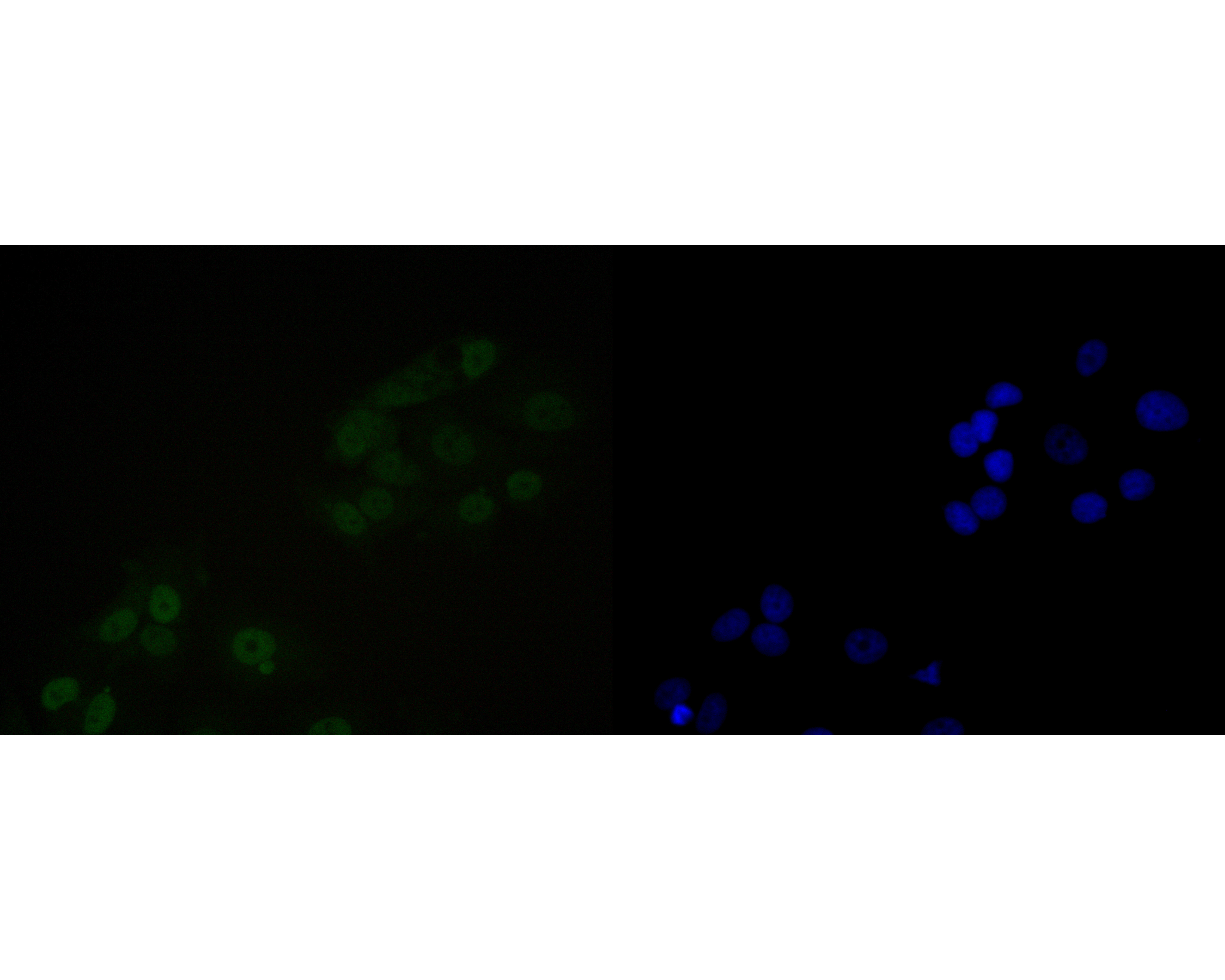 ICC staining of NuMA in MCF-7 cells (green). Formalin fixed cells were permeabilized with 0.1% Triton X-100 in TBS for 10 minutes at room temperature and blocked with 1% Blocker BSA for 15 minutes at room temperature. Cells were probed with the primary antibody (EM1902-16, 1/100) for 1 hour at room temperature, washed with PBS. Alexa Fluor®488 Goat anti-Mouse IgG was used as the secondary antibody at 1/1,000 dilution. The nuclear counter stain is DAPI (blue).