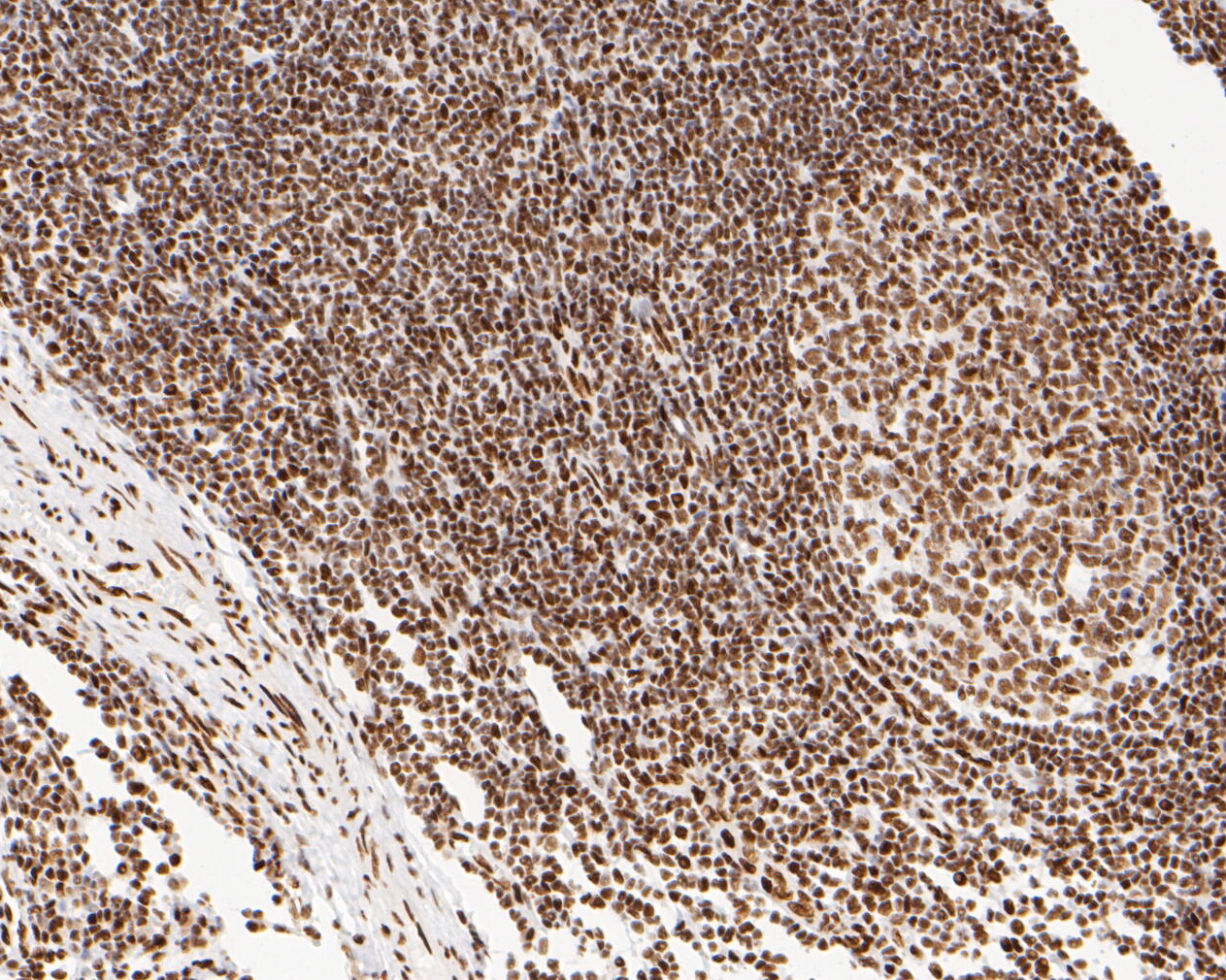Immunohistochemical analysis of paraffin-embedded human tonsil tissue using anti-NuMA antibody. The section was pre-treated using heat mediated antigen retrieval with sodium citrate buffer (pH 6.0) for 20 minutes. The tissues were blocked in 5% BSA for 30 minutes at room temperature, washed with ddH2O and PBS, and then probed with the primary antibody (EM1902-16, 1/500)  for 30 minutes at room temperature. The detection was performed using an HRP conjugated compact polymer system. DAB was used as the chromogen. Tissues were counterstained with hematoxylin and mounted with DPX.