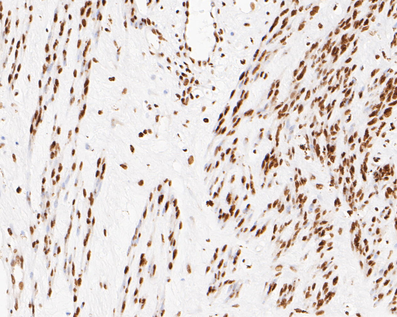 Immunohistochemical analysis of paraffin-embedded human cervix tissue using anti-NuMA antibody. The section was pre-treated using heat mediated antigen retrieval with sodium citrate buffer (pH 6.0) for 20 minutes. The tissues were blocked in 5% BSA for 30 minutes at room temperature, washed with ddH2O and PBS, and then probed with the primary antibody (EM1902-16, 1/500)  for 30 minutes at room temperature. The detection was performed using an HRP conjugated compact polymer system. DAB was used as the chromogen. Tissues were counterstained with hematoxylin and mounted with DPX.