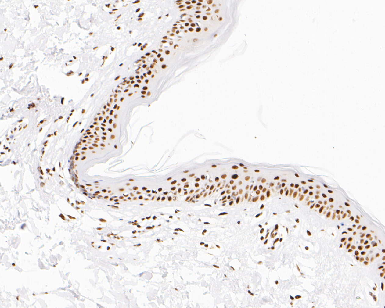 Immunohistochemical analysis of paraffin-embedded human skin tissue using anti-NuMA antibody. The section was pre-treated using heat mediated antigen retrieval with sodium citrate buffer (pH 6.0) for 20 minutes. The tissues were blocked in 5% BSA for 30 minutes at room temperature, washed with ddH2O and PBS, and then probed with the primary antibody (EM1902-16, 1/500)  for 30 minutes at room temperature. The detection was performed using an HRP conjugated compact polymer system. DAB was used as the chromogen. Tissues were counterstained with hematoxylin and mounted with DPX.