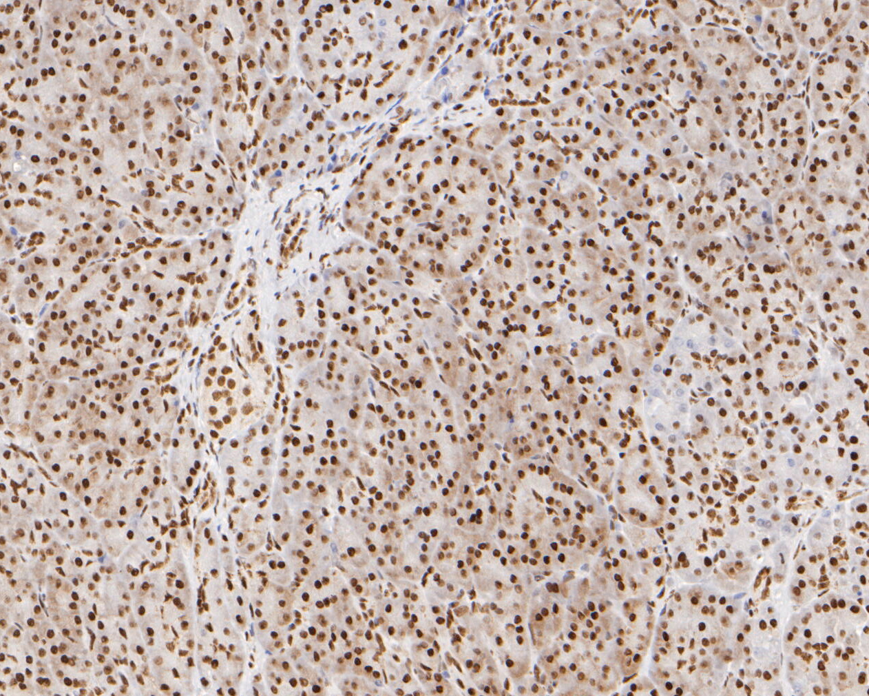 Immunohistochemical analysis of paraffin-embedded human pancreas tissue using anti-NuMA antibody. The section was pre-treated using heat mediated antigen retrieval with sodium citrate buffer (pH 6.0) for 20 minutes. The tissues were blocked in 5% BSA for 30 minutes at room temperature, washed with ddH2O and PBS, and then probed with the primary antibody (EM1902-16, 1/500)  for 30 minutes at room temperature. The detection was performed using an HRP conjugated compact polymer system. DAB was used as the chromogen. Tissues were counterstained with hematoxylin and mounted with DPX.