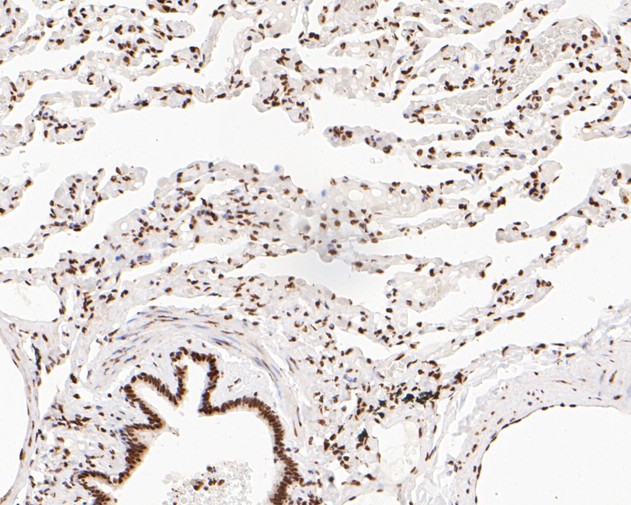 Immunohistochemical analysis of paraffin-embedded human lung tissue using anti-NuMA antibody. The section was pre-treated using heat mediated antigen retrieval with sodium citrate buffer (pH 6.0) for 20 minutes. The tissues were blocked in 5% BSA for 30 minutes at room temperature, washed with ddH2O and PBS, and then probed with the primary antibody (EM1902-17, 1/500)  for 30 minutes at room temperature. The detection was performed using an HRP conjugated compact polymer system. DAB was used as the chromogen. Tissues were counterstained with hematoxylin and mounted with DPX.