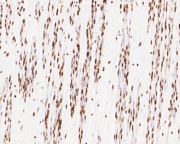 Immunohistochemical analysis of paraffin-embedded human cervix tissue using anti-NuMA antibody. The section was pre-treated using heat mediated antigen retrieval with sodium citrate buffer (pH 6.0) for 20 minutes. The tissues were blocked in 5% BSA for 30 minutes at room temperature, washed with ddH2O and PBS, and then probed with the primary antibody (EM1902-17, 1/500)  for 30 minutes at room temperature. The detection was performed using an HRP conjugated compact polymer system. DAB was used as the chromogen. Tissues were counterstained with hematoxylin and mounted with DPX.