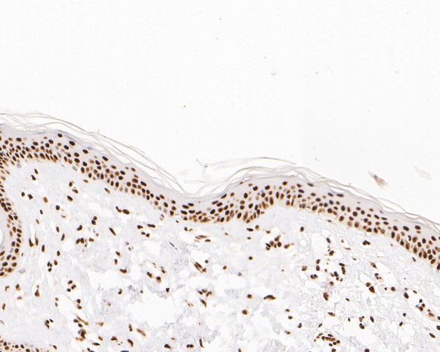 Immunohistochemical analysis of paraffin-embedded human skin tissue using anti-NuMA antibody. The section was pre-treated using heat mediated antigen retrieval with sodium citrate buffer (pH 6.0) for 20 minutes. The tissues were blocked in 5% BSA for 30 minutes at room temperature, washed with ddH2O and PBS, and then probed with the primary antibody (EM1902-17, 1/500)  for 30 minutes at room temperature. The detection was performed using an HRP conjugated compact polymer system. DAB was used as the chromogen. Tissues were counterstained with hematoxylin and mounted with DPX.