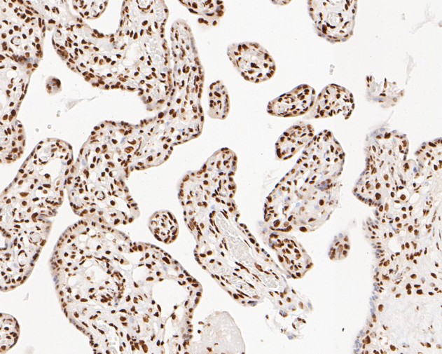 Immunohistochemical analysis of paraffin-embedded human placenta tissue using anti-NuMA antibody. The section was pre-treated using heat mediated antigen retrieval with sodium citrate buffer (pH 6.0) for 20 minutes. The tissues were blocked in 5% BSA for 30 minutes at room temperature, washed with ddH2O and PBS, and then probed with the primary antibody (EM1902-17, 1/500)  for 30 minutes at room temperature. The detection was performed using an HRP conjugated compact polymer system. DAB was used as the chromogen. Tissues were counterstained with hematoxylin and mounted with DPX.