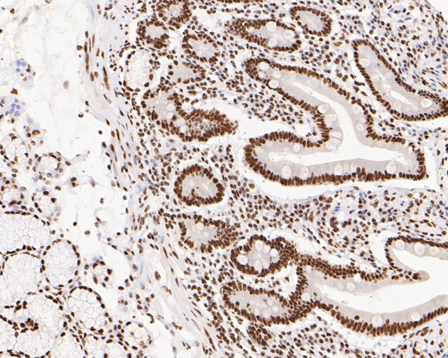 Immunohistochemical analysis of paraffin-embedded human small intestine tissue using anti-NuMA antibody. The section was pre-treated using heat mediated antigen retrieval with sodium citrate buffer (pH 6.0) for 20 minutes. The tissues were blocked in 5% BSA for 30 minutes at room temperature, washed with ddH2O and PBS, and then probed with the primary antibody (EM1902-17, 1/500)  for 30 minutes at room temperature. The detection was performed using an HRP conjugated compact polymer system. DAB was used as the chromogen. Tissues were counterstained with hematoxylin and mounted with DPX.