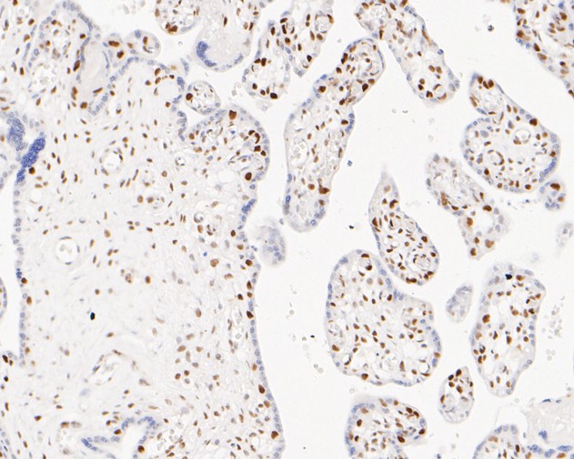 Immunohistochemical analysis of paraffin-embedded human placenta tissue with Mouse anti-MSH6 antibody (EM1902-24) at 1/200 dilution.<br />
<br />
The section was pre-treated using heat mediated antigen retrieval with sodium citrate buffer (pH 6.0) for 2 minutes. The tissues were blocked in 1% BSA for 20 minutes at room temperature, washed with ddH2O and PBS, and then probed with the primary antibody (EM1902-24) at 1/200 dilution for 1 hour at room temperature. The detection was performed using an HRP conjugated compact polymer system. DAB was used as the chromogen. Tissues were counterstained with hematoxylin and mounted with DPX.