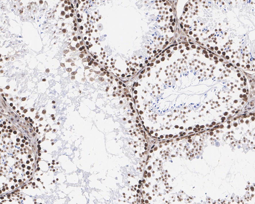 Immunohistochemical analysis of paraffin-embedded mouse testis tissue using anti-MSH6 antibody. The section was pre-treated using heat mediated antigen retrieval with sodium citrate buffer (pH 6.0) for 20 minutes. The tissues were blocked in 5% BSA for 30 minutes at room temperature, washed with ddH2O and PBS, and then probed with the primary antibody (EM1902-24, 1/200)  for 30 minutes at room temperature. The detection was performed using an HRP conjugated compact polymer system. DAB was used as the chromogen. Tissues were counterstained with hematoxylin and mounted with DPX.