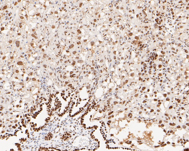 Immunohistochemical analysis of paraffin-embedded mouse placenta tissue with Mouse anti-MSH6 antibody (EM1902-24) at 1/200 dilution.<br />
<br />
The section was pre-treated using heat mediated antigen retrieval with sodium citrate buffer (pH 6.0) for 2 minutes. The tissues were blocked in 1% BSA for 20 minutes at room temperature, washed with ddH2O and PBS, and then probed with the primary antibody (EM1902-24) at 1/200 dilution for 1 hour at room temperature. The detection was performed using an HRP conjugated compact polymer system. DAB was used as the chromogen. Tissues were counterstained with hematoxylin and mounted with DPX.