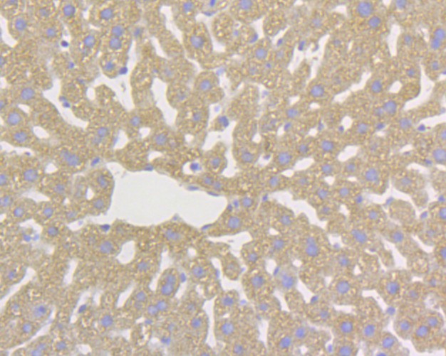 Immunohistochemical analysis of paraffin-embedded mouse liver  tissue using anti-DAP Kinase 1 antibody. The section was pre-treated using heat mediated antigen retrieval with Tris-EDTA buffer (pH 8.0-8.4) for 20 minutes.The tissues were blocked in 5% BSA for 30 minutes at room temperature, washed with ddH2O and PBS, and then probed with the primary antibody (EM1902-25, 1/100) for 30 minutes at room temperature. The detection was performed using an HRP conjugated compact polymer system. DAB was used as the chromogen. Tissues were counterstained with hematoxylin and mounted with DPX.