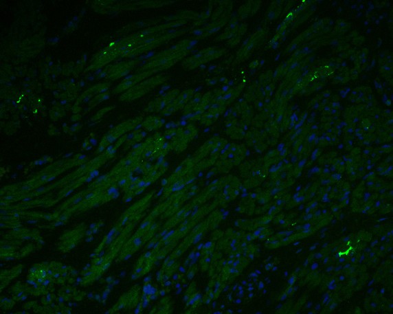 Immunofluorescence staining of paraffin- embedded human fetal skeletal muscle tissue using anti-Myoglobin antibody.The section was pre-treated using heat mediated antigen retrieval with Tris-EDTA buffer (pH 9.0) for 20 minutes.(sodium citrate buffer (pH6) for 20 mins.) The tissues were blocked in 10% negative goat serum for 1 hour at room temperature, washed with PBS, and then probed with EM1902-27 at 1/50 dilution for 10 hours at 4℃ and detected using Alexa Fluor® 488 conjugate-Goat anti-Rabbit IgG (H+L) Secondary Antibody at a dilution of 1:500 for 1 hour at room temperature.