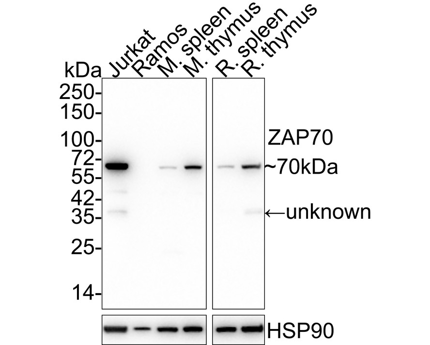 Western blot analysis of ZAP70 on Jurkat cell lysates with Mouse anti-ZAP70 antibody (EM1902-28) at 1/2,000 dilution.<br />
<br />
Lysates/proteins at 10 µg/Lane.<br />
<br />
Predicted band size: 70 kDa<br />
Observed band size: 70 kDa<br />
<br />
Exposure time: 2 minutes;<br />
<br />
8% SDS-PAGE gel.<br />
<br />
Proteins were transferred to a PVDF membrane and blocked with 5% NFDM/TBST for 1 hour at room temperature. The primary antibody (EM1902-28) at 1/2,000 dilution was used in 5% NFDM/TBST at room temperature for 2 hours. Goat Anti-Mouse IgG - HRP Secondary Antibody (HA1006) at 1:100,000 dilution was used for 1 hour at room temperature.