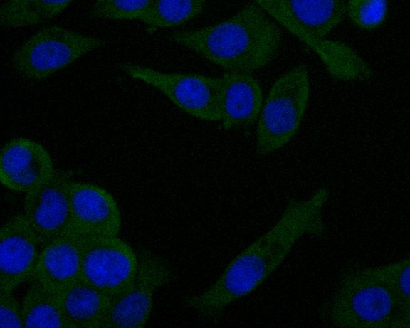 ICC staining of ZAP70 in LOVO cells (green). Formalin fixed cells were permeabilized with 0.1% Triton X-100 in TBS for 10 minutes at room temperature and blocked with 1% Blocker BSA for 15 minutes at room temperature. Cells were probed with the primary antibody (EM1902-28, 1/50) for 1 hour at room temperature, washed with PBS. Alexa Fluor®488 Goat anti-Mouse IgG was used as the secondary antibody at 1/100 dilution. The nuclear counter stain is DAPI (blue).