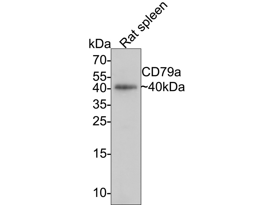 Western blot analysis of CD79a on rat spleen tissue lysates with Mouse anti-CD79a antibody (EM1902-29) at 1/1,000 dilution.<br />
<br />
Lysates/proteins at 20 µg/Lane.<br />
<br />
Predicted band size: 25 kDa<br />
Observed band size: 40 kDa<br />
<br />
Exposure time: 2 minutes;<br />
<br />
15% SDS-PAGE gel.<br />
<br />
Proteins were transferred to a PVDF membrane and blocked with 5% NFDM/TBST for 1 hour at room temperature. The primary antibody (EM1902-29) at 1/1,000 dilution was used in 5% NFDM/TBST at room temperature for 2 hours. Goat Anti-Mouse IgG - HRP Secondary Antibody (HA1006) at 1:150,000 dilution was used for 1 hour at room temperature.