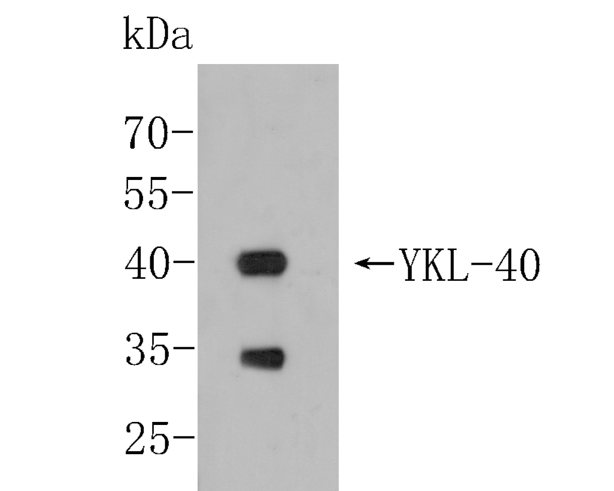 Western blot analysis of YKL-40/CHI3L1 on THP-1 cell lysates. Proteins were transferred to a PVDF membrane and blocked with 5% BSA in PBS for 1 hour at room temperature. The primary antibody (EM1902-31, 1/500) was used in 5% BSA at room temperature for 2 hours. Goat Anti-Mouse IgG - HRP Secondary Antibody (HA1006) at 1:5,000 dilution was used for 1 hour at room temperature.