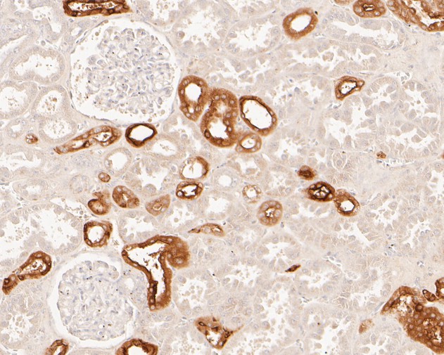 Immunohistochemical analysis of paraffin-embedded human kidney tissue using anti-MUC1 antibody. The section was pre-treated using heat mediated antigen retrieval with sodium citrate buffer (pH 6.0) for 20 minutes. The tissues were blocked in 5% BSA for 30 minutes at room temperature, washed with ddH2O and PBS, and then probed with the primary antibody (EM1902-32, 1/400)  for 30 minutes at room temperature. The detection was performed using an HRP conjugated compact polymer system. DAB was used as the chromogen. Tissues were counterstained with hematoxylin and mounted with DPX.
