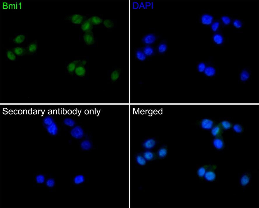 Immunocytochemistry analysis of LOVO cells labeling Bmi1 with Mouse anti-Bmi1 antibody (EM20602) at 1/50 dilution.<br />
<br />
Cells were fixed in 4% paraformaldehyde for 30 minutes, permeabilized with 0.1% Triton X-100 in PBS for 15 minutes, and then blocked with 2% BSA for 30 minutes at room temperature. Cells were then incubated with Mouse anti-Bmi1 antibody (EM20602) at 1/50 dilution in 2% BSA overnight at 4 ℃. Goat Anti-Mouse IgG H&L (iFluor™ 488, HA1125) was used as the secondary antibody at 1/1,000 dilution. PBS instead of the primary antibody was used as the secondary antibody only control. Nuclear DNA was labelled in blue with DAPI.