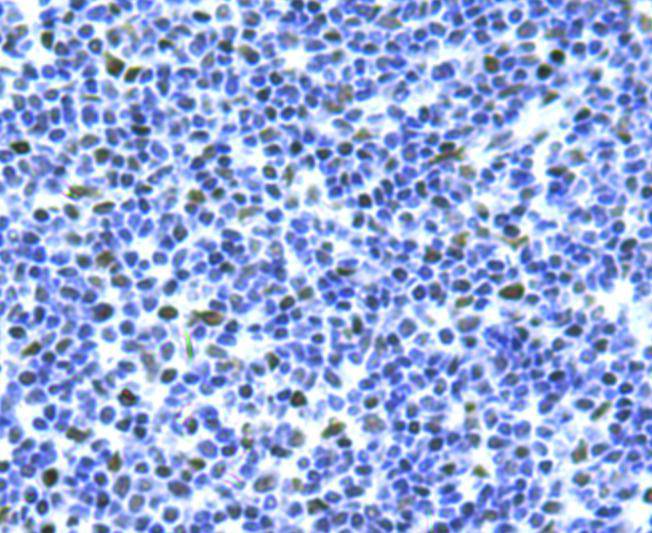Immunohistochemical analysis of paraffin-embedded human tonsil tissue using anti-Bmi1 antibody. Counter stained with hematoxylin.