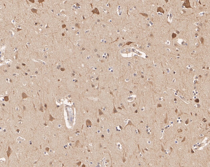 Immunohistochemical analysis of paraffin-embedded human brain tissue with Mouse anti-HSP90 Beta antibody (EM21103) at 1/10,000 dilution.<br />
<br />
The section was pre-treated using heat mediated antigen retrieval with Tris-EDTA buffer (pH 9.0) for 20 minutes. The tissues were blocked in 1% BSA for 20 minutes at room temperature, washed with ddH2O and PBS, and then probed with the primary antibody (EM21103) at 1/10,000 dilution for 1 hour at room temperature. The detection was performed using an HRP conjugated compact polymer system. DAB was used as the chromogen. Tissues were counterstained with hematoxylin and mounted with DPX.