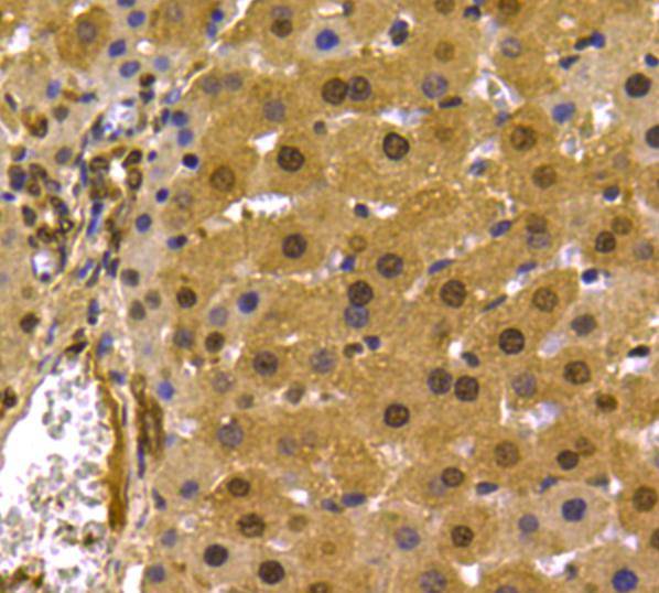 Immunohistochemical analysis of paraffin-embedded rat liver tissue using anti-PRMT5 antibody. Counter stained with hematoxylin.