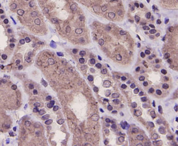 Immunohistochemical analysis of paraffin-embedded human kidney tissue using anti-PRMT5 antibody. Counter stained with hematoxylin.